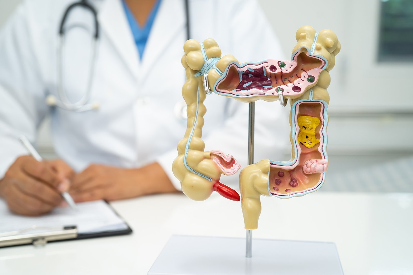 Leaky Gut: What It Is, Why It Happens, and How to Fix It