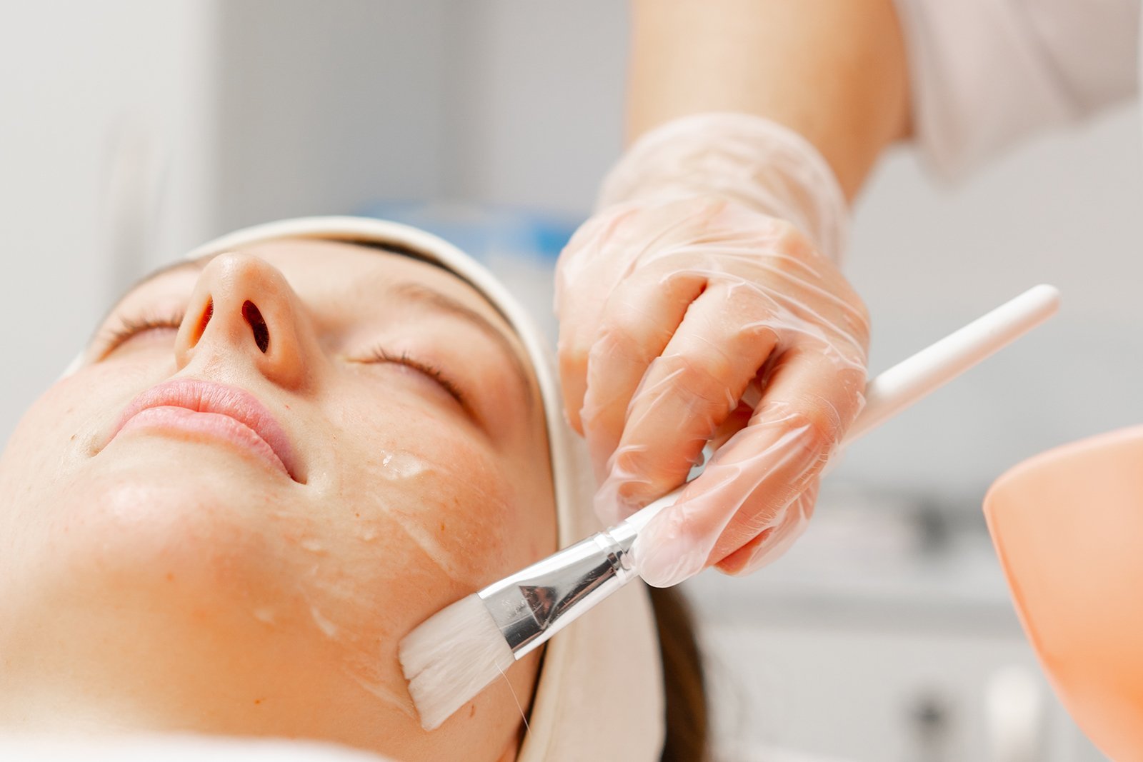 Derma Peel 101: Your Beginner’s Guide to Chemical Exfoliation