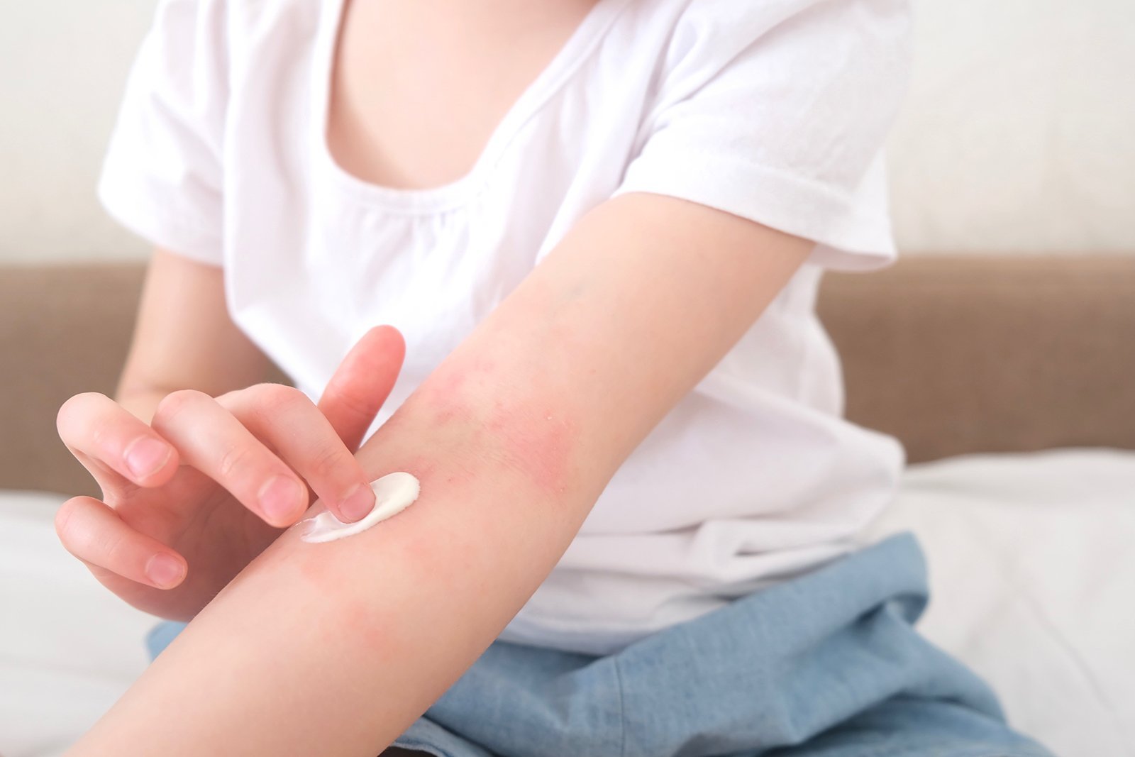 Your Gut Is Talking Through Your Skin – The Hidden Root of Eczema & Inflammation